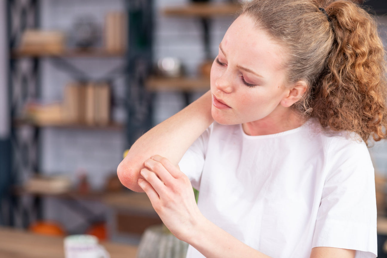Plant-Based Ingredients That Help Soothe Skin Irritation